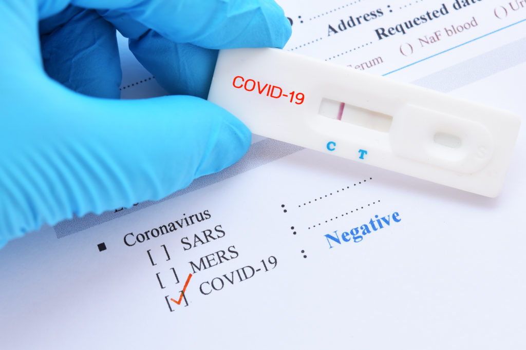 Negative COVID-19 test results